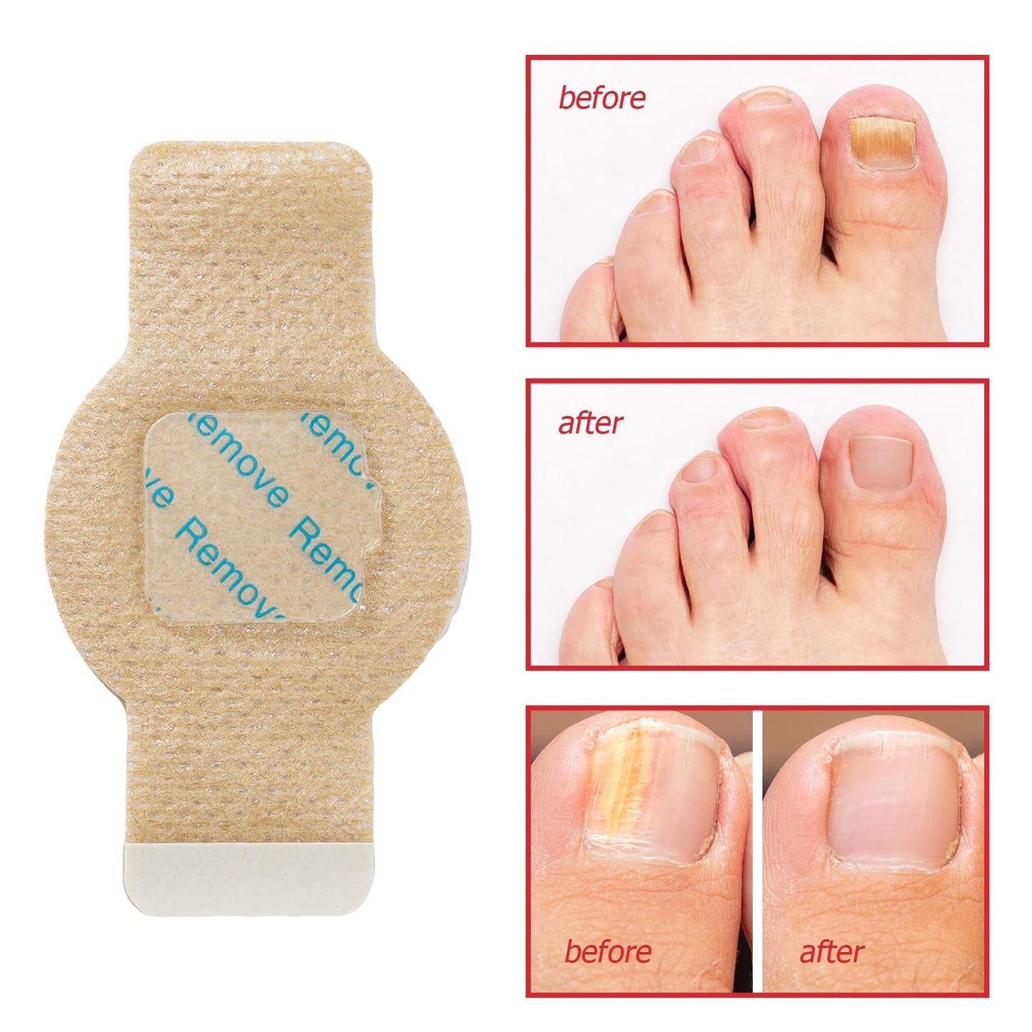 LTQXGT Fungal Nail Patches – Extra Strength Toenail Patches (21 Pcs)