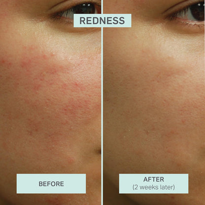 LUMION Save My Skin HOCl Serum – Calm, Balance & Clarity for All Skin Types