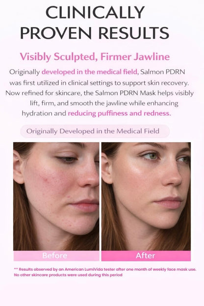 LumiVida Salmon DNA PDRN Jelly Gel Mask – Overnight Firming & Hydration (4 Pack) | K-Beauty with Niacinamide & Peptides