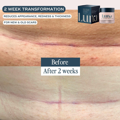 Luna Daily Stretch Mark & Scar Gel | Repair & Hydration with Arnica & Cacay Oil | 50ml