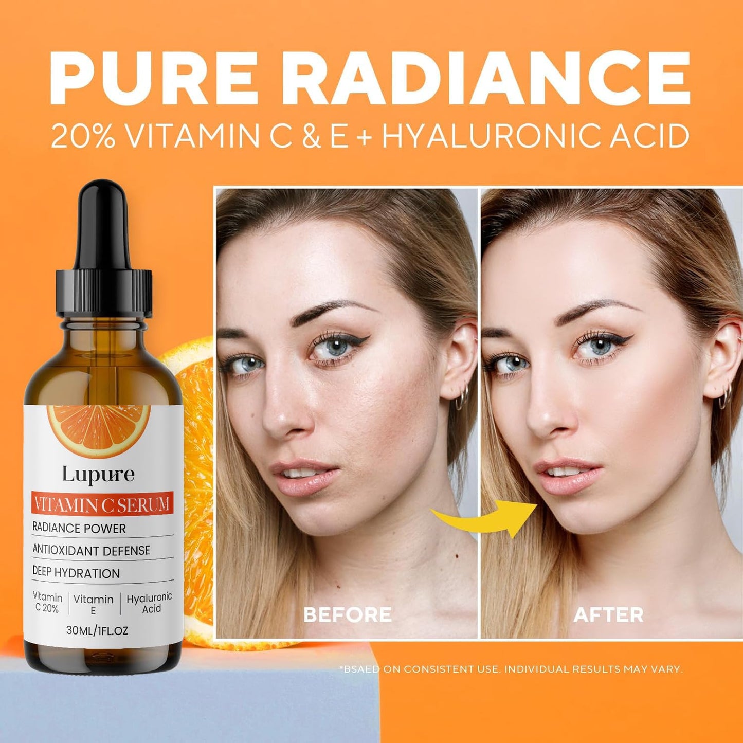 Lupure Professional Vitamin C Serum 20% - Hyaluronic Acid & Vitamin E for Brightening | 1 oz