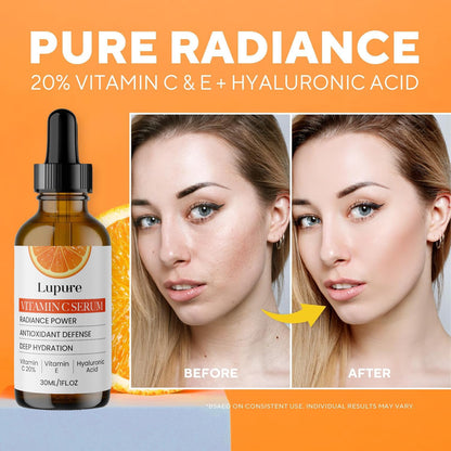 Lupure Professional Vitamin C Serum 20% - Hyaluronic Acid & Vitamin E for Brightening | 1 oz