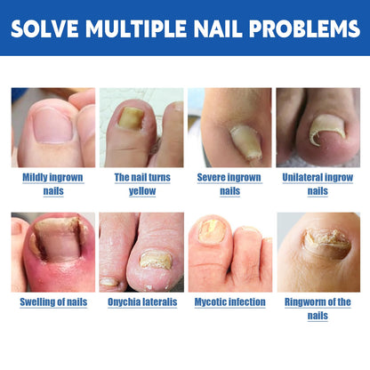 LYFXuGeMLM 20 Patches Fungal Nail Repair – Toenail Restoration, 8-Hour Intensive Treatment