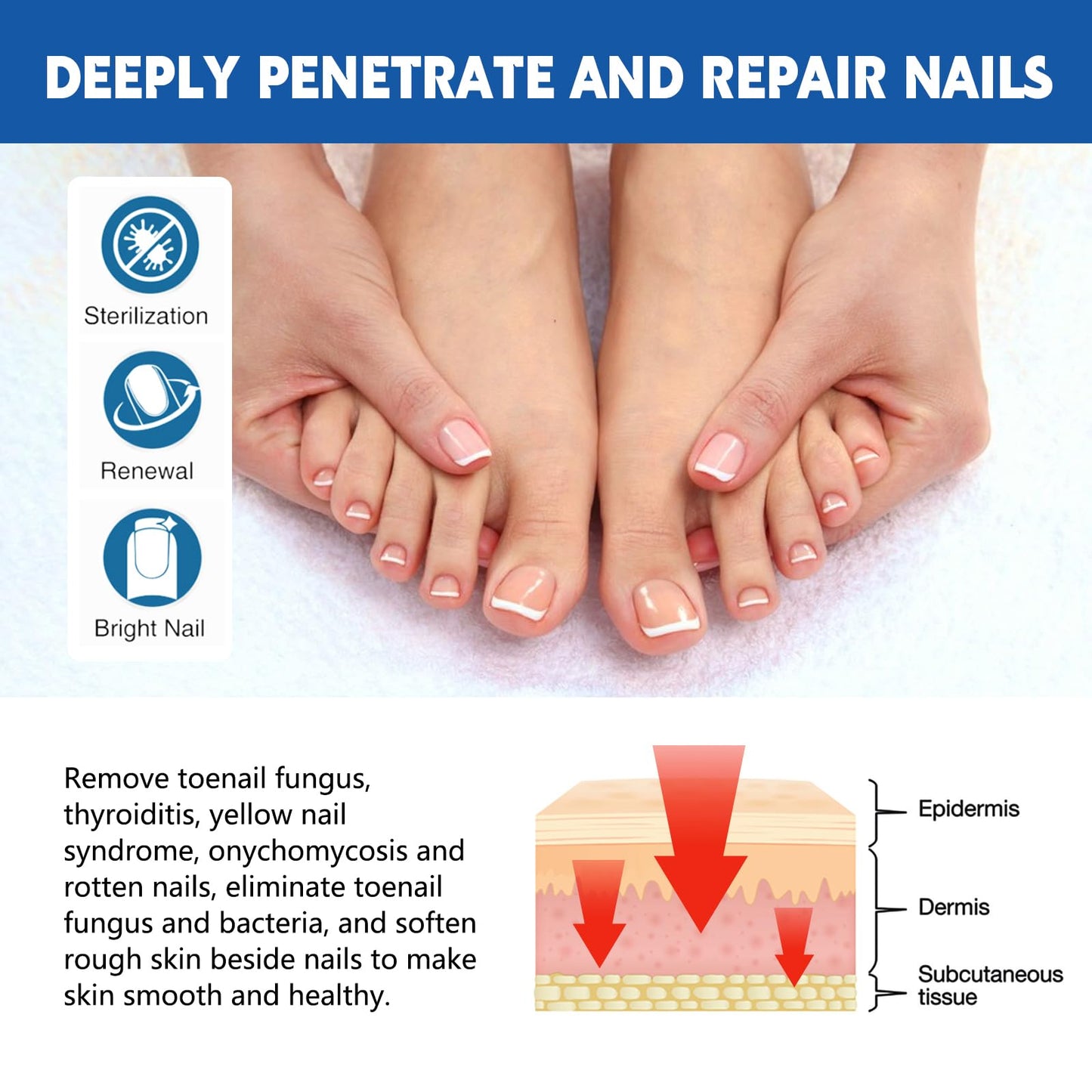 LYFXuGeMLM 20 Patches Fungal Nail Repair – Toenail Restoration, 8-Hour Intensive Treatment