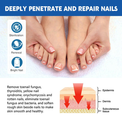 LYFXuGeMLM 20 Patches Fungal Nail Repair – Toenail Restoration, 8-Hour Intensive Treatment