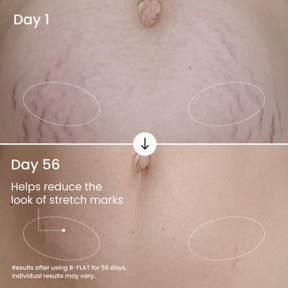 MAËLYS B-FLAT Belly Firming Cream - Postpartum Skin Tightening & Moisturizing (3.4 Fl Oz)