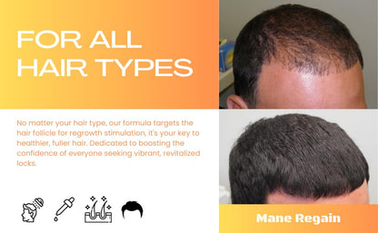 Mane Regain Minoxidil 5% Topical Solution for Men - Extra Strength, Unscented, 6 oz (3-Pack)