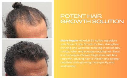 Mane Regain Minoxidil 5% Topical Solution for Men - Extra Strength, Unscented, 6 oz (3-Pack)