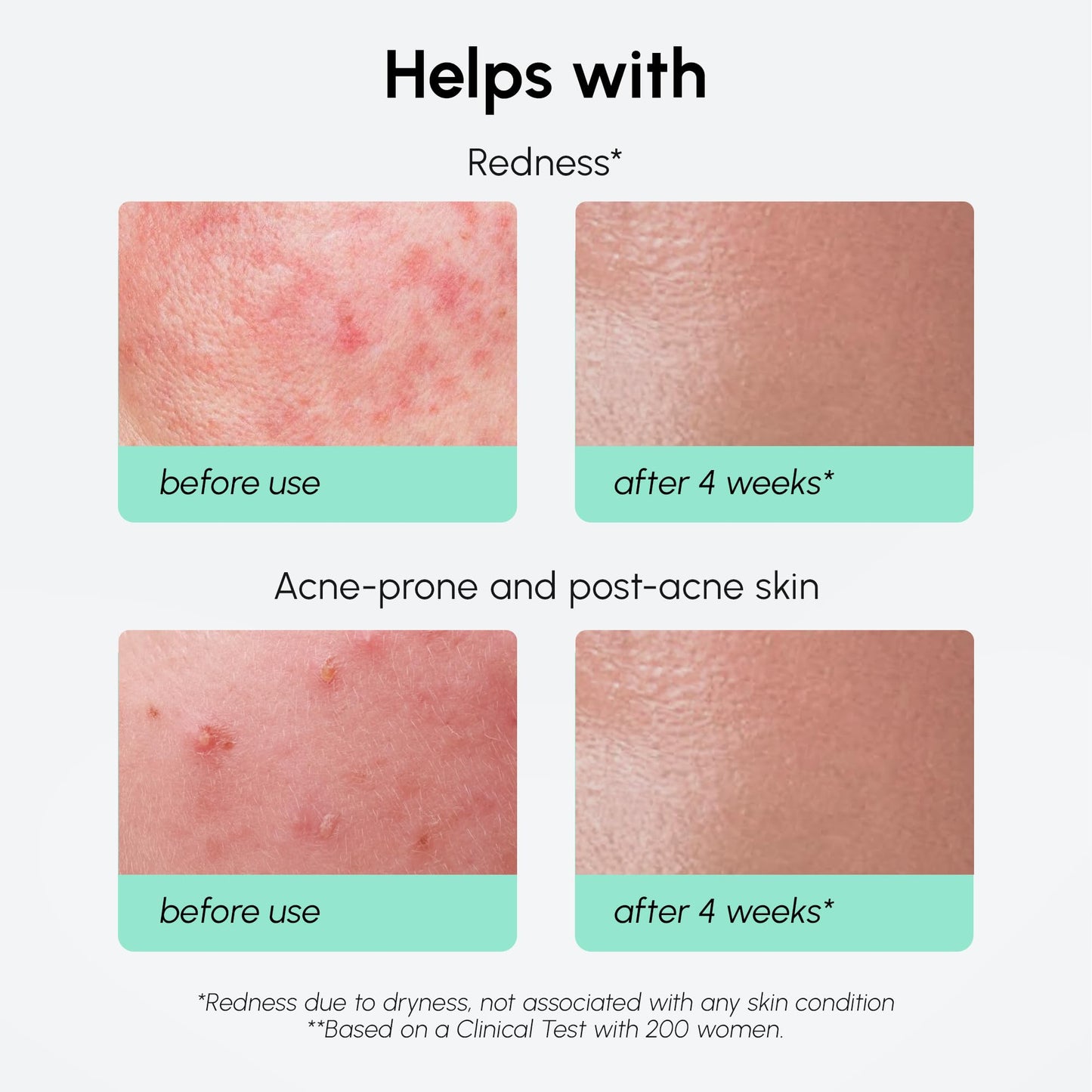 MAREE 10% Azelaic Acid Serum – Calming, Hydrating Face Serum with Niacinamide, Centella & Hyaluronic Acid