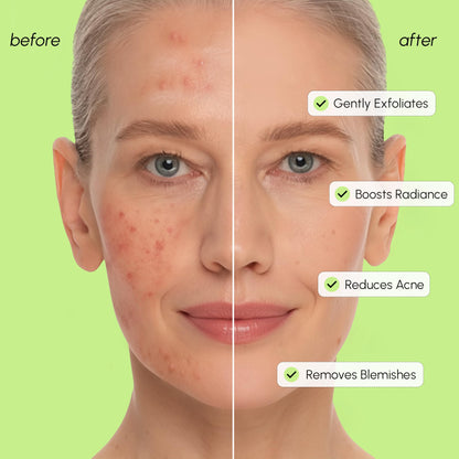 MAREE Exfoliating Toner with Salicylic Acid – AHA BHA Face Exfoliant & Pore Cleaner