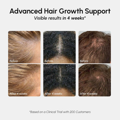 MAREE Hair Growth Spray – Caffeine, Rosemary & Castor Oil for Fuller-Looking Hair