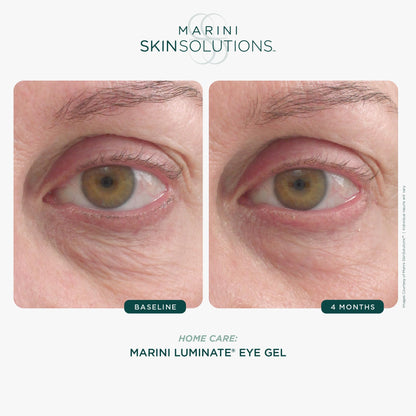 Marini SkinSolutions Luminate Eye Gel – Brighten Dark Circles & Smooth Eye Area