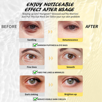 Maskiss Retinol Under Eye Patches (24 Pairs) – Firming, Hydration & Brightening