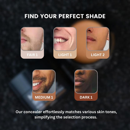 MATTR Skin Fix - Luxury Tinted Concealer for Men, 15g | Covers Blemishes, Razor Burns, Under-Eye Bags