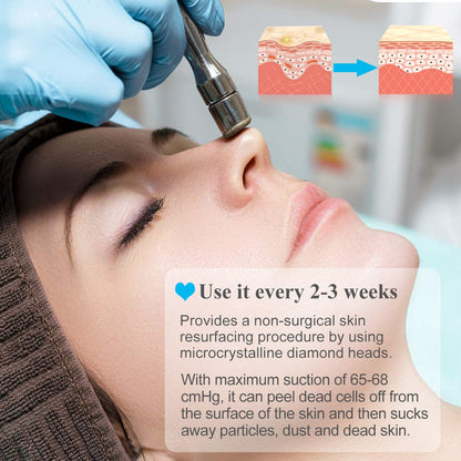 Mcwdoit Upgraded Diamond Microdermabrasion Machine – 65-68 cmHg Suction, Skin Rejuvenation, Lifting & Tightening