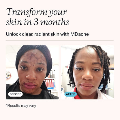 MDacne 3 Step Retinol Acne Kit — 0.25% Retinol, Salicylic Cleanser & Niacinamide Moisturizer