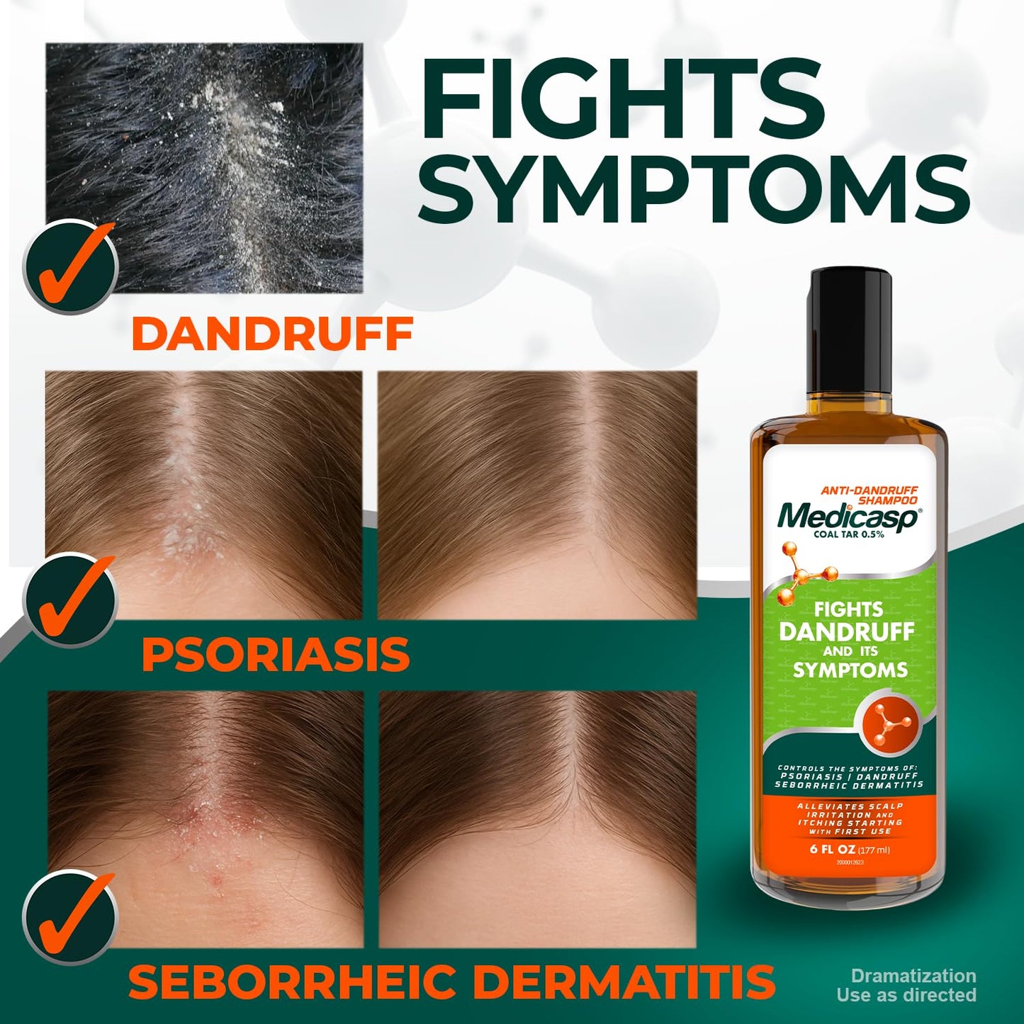 Medicasp Coal Tar Anti-Dandruff Shampoo – Starts Working From First Wash, 2-Pack (6 oz each)