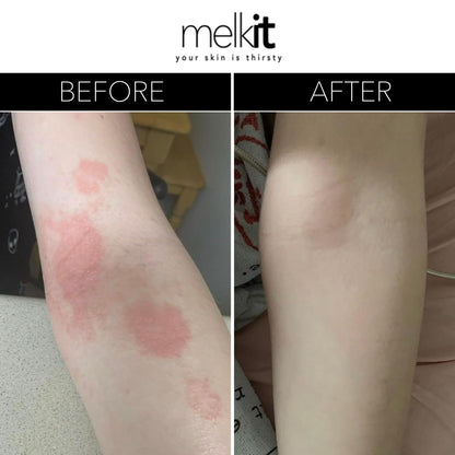 Melkit Body Melk Natural Body Cream – Fast-Absorbing Hydration for Dry & Sensitive Skin (16 oz)
