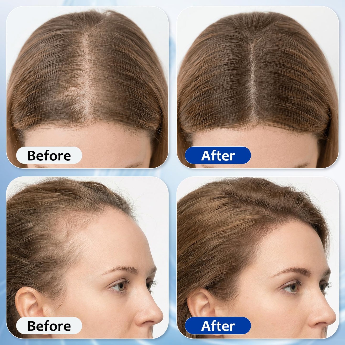 MGVAASURC Hair Growth Serum Roll-On – 3% Rosemary, 3% Batana Oil, 2% Pea Extract, 2% Ginger Root Oil