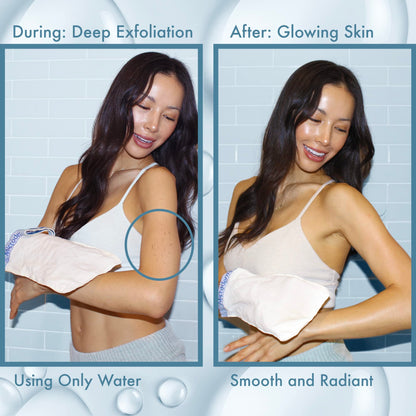 MicrodermaMitt Original Deep Exfoliating Mitt for Body | Premium Turkish Kessa Glove