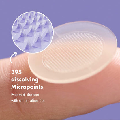 Mighty Patch Micropoint 395 for Dark Spots | Post-Blemish Patch