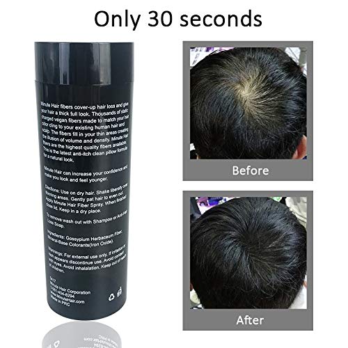 Minute Hair Biggie Sized 57g Dark Brown Hair Fibers – Refillable Bottle