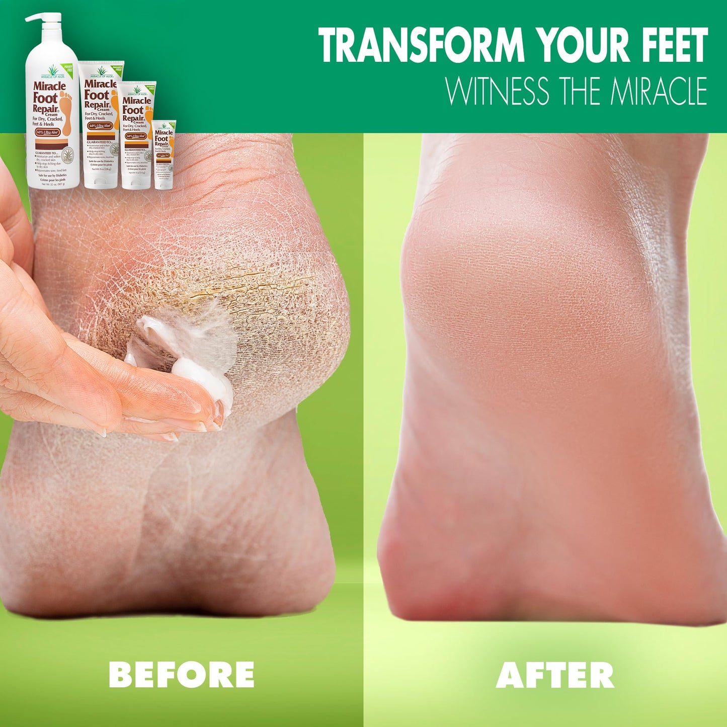 Miracle Foot Repair Cream — 60% Ultra Aloe (8 oz & 1 oz)