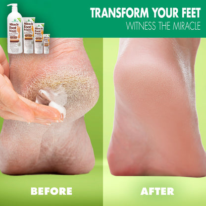 Miracle Foot Repair Cream — 60% Ultra Aloe (8 oz & 1 oz)