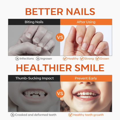 modelones Gel Nail Biting Treatment – Bitter Deterrent Nail Polish for Kids & Adults | Stop Nail Biting & Support Growth