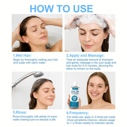 Morovan Coal Tar Shampoo 2%: Severe Dandruff & Itchy Scalp