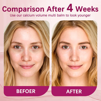 MQN 2PCS Calcium Stick – Calcium Volume Multi Bomb Balm for Face, Eyes & Neck | Korean Collagen Core Balm with Almond Vitamin E