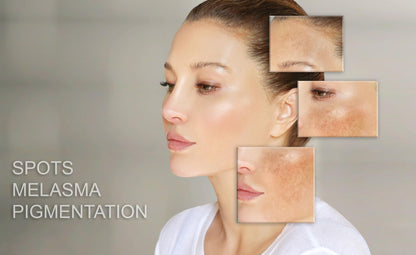 MT SKIN CLINIC Pro Intense Anti Aging Day Cream – Hydration, Redness Relief & Sensitive Skin Support