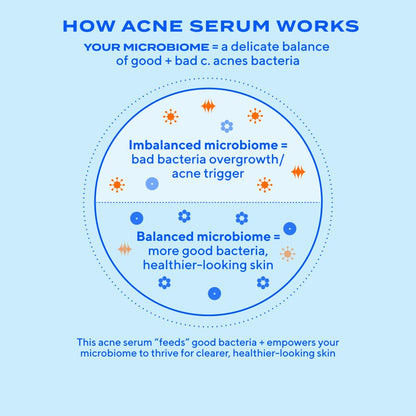 Murad Biome-Balancing Acne Treatment Serum – Salicylic, Mandelic & Glutamic Acids | 1.0 fl oz