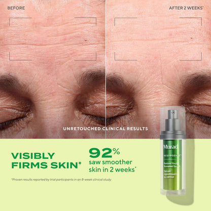Murad Youth Renewal Retinol Trial Kit – 3-Piece Anti-Aging Set