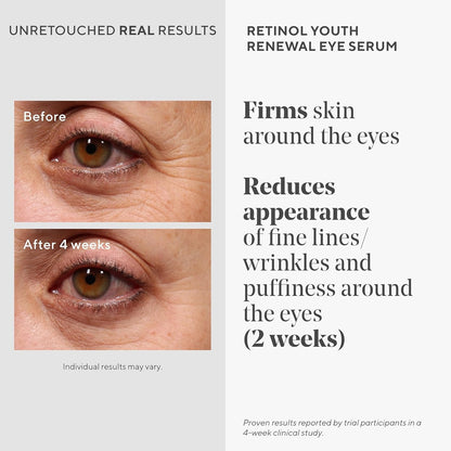 Murad Youth Renewal Retinol Trial Kit – 3-Piece Anti-Aging Set