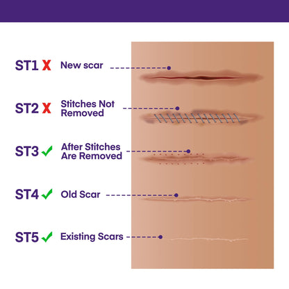 MURASAKI BEAUTY Silicone Scar Gel SPF 30 – Advanced Medical-Grade Scar Cream 1.06oz