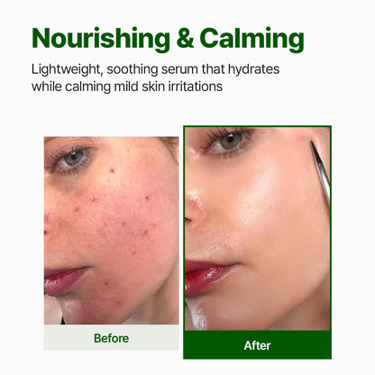 NACIFIC Cica PDRN Centella Serum – Calming, Hydrating Centella Ampoule for Sensitive Skin (50ml)