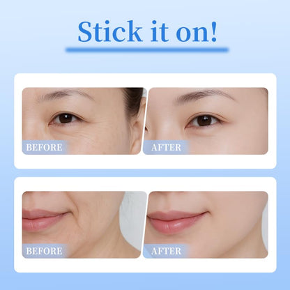 Natener 4 Pairs PDRN Micro Eye Patches | Hyaluronic Acid, Kojic Acid, Collagen + Peptides