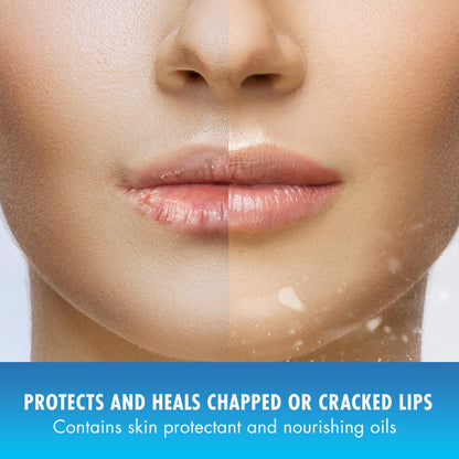 Natural Ice Lip Balm Original SPF 15 – 0.16 oz Tubes, Pack of 48