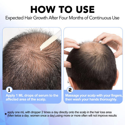 Nature Ziran Minoxidil 5% Extra Strength Hair Regrowth for Men & Women – Dropper Applicator Included