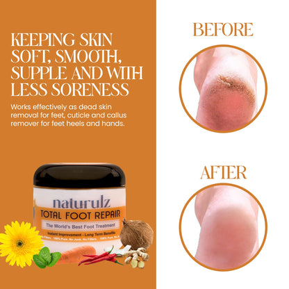Naturulz Total Foot Repair 4oz – Intensive Moisture Foot Cream for Dry, Rough Skin & Cracked Heels