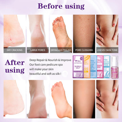 NBC BeautiLab Pedicure Kit Foot Spa Set – Lavender 6-Piece Foot Care: Bubble Salt, Sugar Scrub, Massage Mask & Lotion