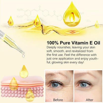 NenMaoKeNu 2 Pack Vitamin E Oil 75,000 IU – Hydration, Fine Line & Scar Support