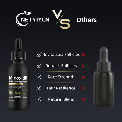 NETYIYUN 5% Minoxidil for Women and Men – Fuller, Thicker Hair (2 oz)