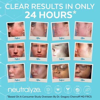 Neutralyze Moderate To Severe Acne Treatment Kit 2.0 – Clearing Serum & Synergyzer