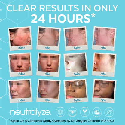 Neutralyze Renewal Complex Acne Moisturizer — Maximum Strength 2% Mandelic + 2% Salicylic, Time-Release