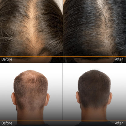 NHTLab Hair Growth Serum for Men & Women - Caffeine & Biotin for Strong Roots (60ml)