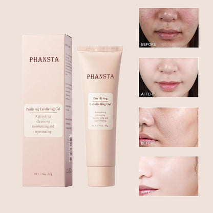 Nichalous Purifying Exfoliating Gel – 2-Pack 50g Gentle Enzymatic Facial Exfoliator