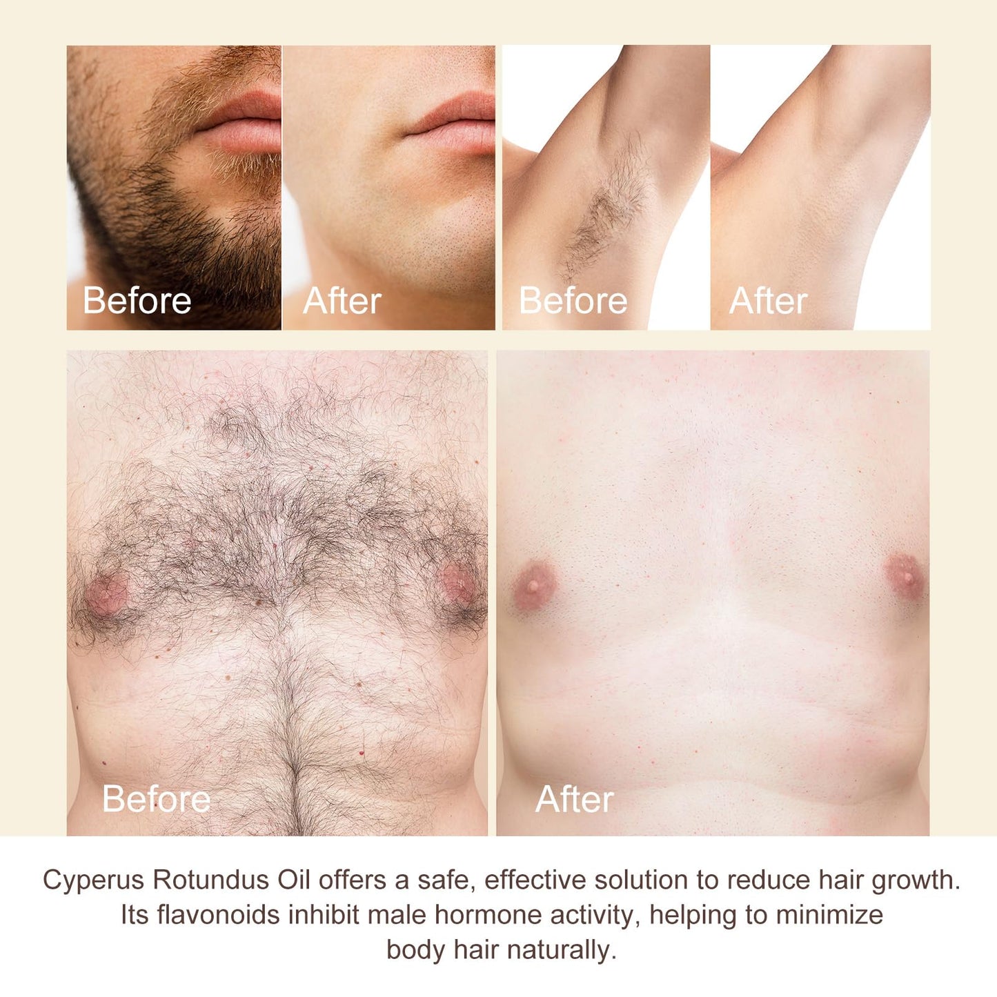 NIFEISHI Cyperus Rotundus Oil for Hair Removal – Gentle, Moisturizing Formula (60ml)
