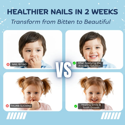 Nipit Honest10 Nail Biting Prevention Pen for Kids – 0.25 oz – USA Made